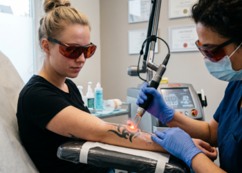 Tattoos weg laseren is nu een trend, maar dit zijn de heftige risico’s..