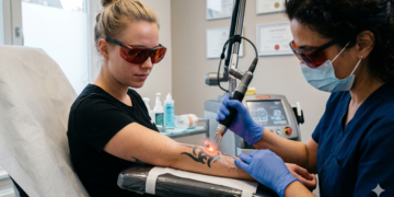Tattoos weg laseren is nu een trend, maar dit zijn de heftige risico’s..