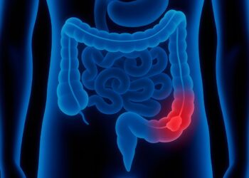 Deze klachten kunnen wijzen op darmkanker en worden vaak genegeerd