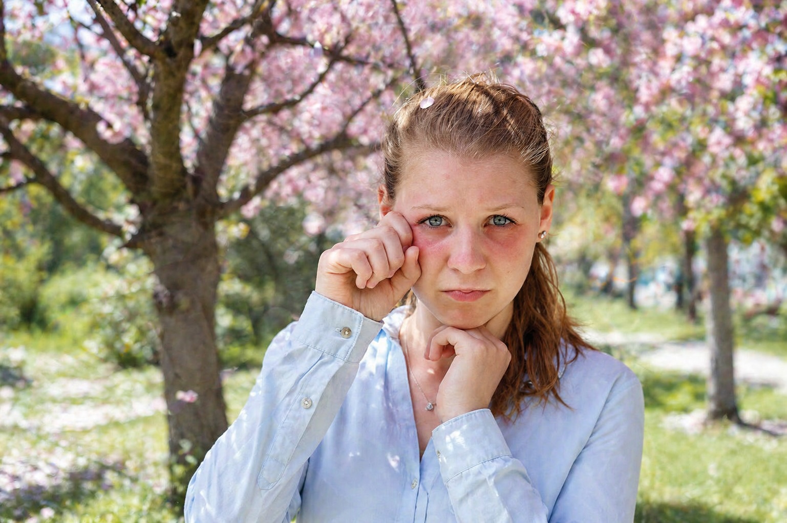 Woman in a light blue shirt rubbing her eye while standing under pink blossoming trees in a sunny park
