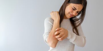 Last van jeuk maar niets te zien? Dit signaal mag je niet negeren