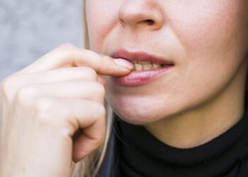 Nooit meer een koortslip – en de oplossing kost nog geen 4 euro!