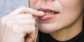 Nooit meer een koortslip – en de oplossing kost nog geen 4 euro!