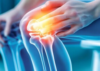 knees, osteoarthritis, body, x-ray, anatomy, pain, medical, health, injury, joints, skeleton, scan, arthritis, bones